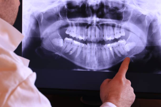 Best Emergency Wisdom Tooth Extraction in Concord, AL